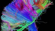 Multibillion-dollar map of human brain might not be worth it