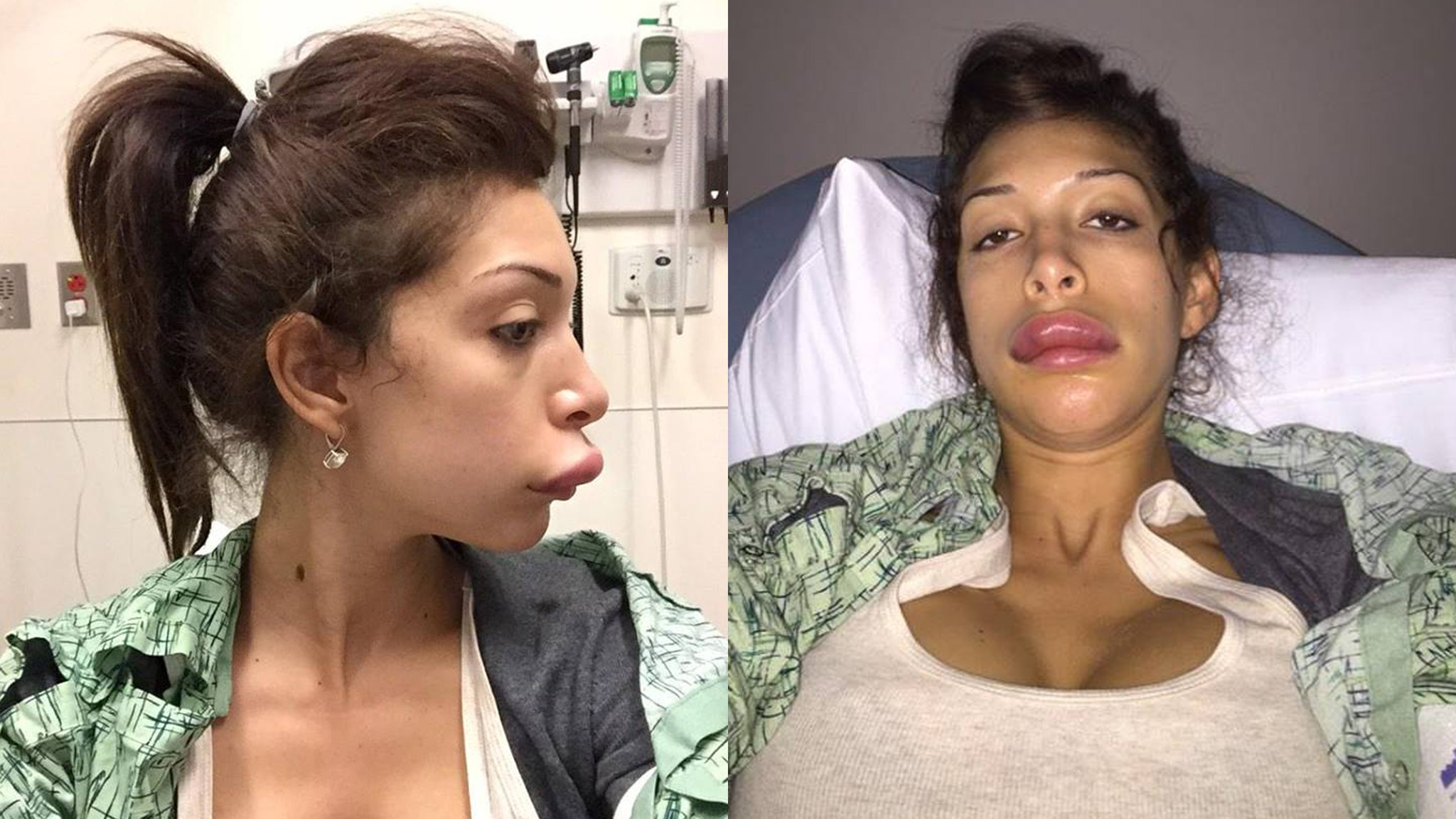 Pictures: Bad celebrity plastic surgery - Orlando Sentinel