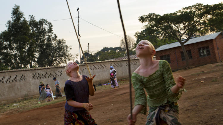 Albinos in danger in Tanzania