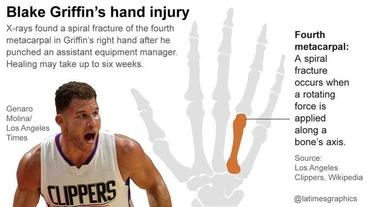 Blake Griffin's hand injury