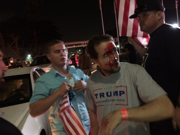 Image result for trump supporter fight
