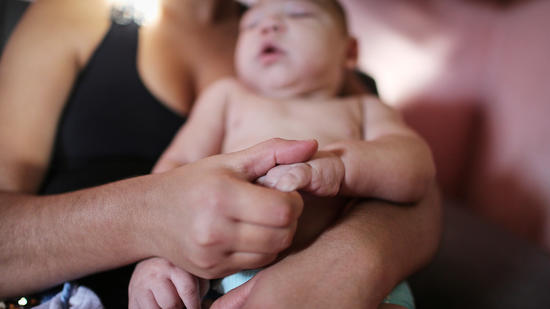 Baby born in U.S. has Zika birth defects