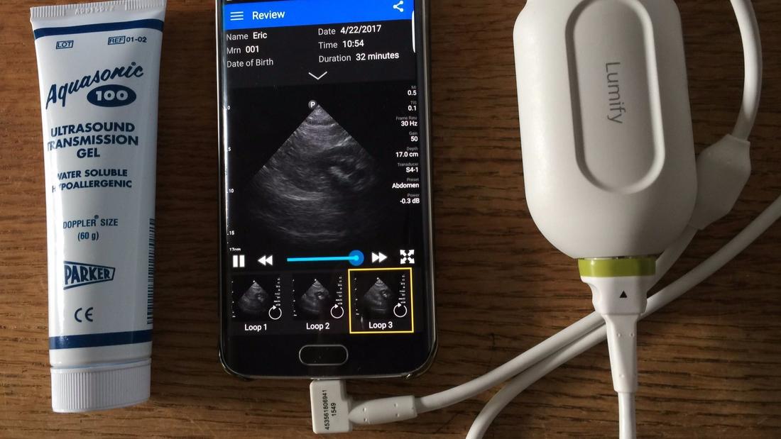 Ultrasound Imaging on Your Smartphone – Way WAY Cool Emergency Diagnostic Tech and For the “Just Curious” to Have a Look Around Inside. 1100x619