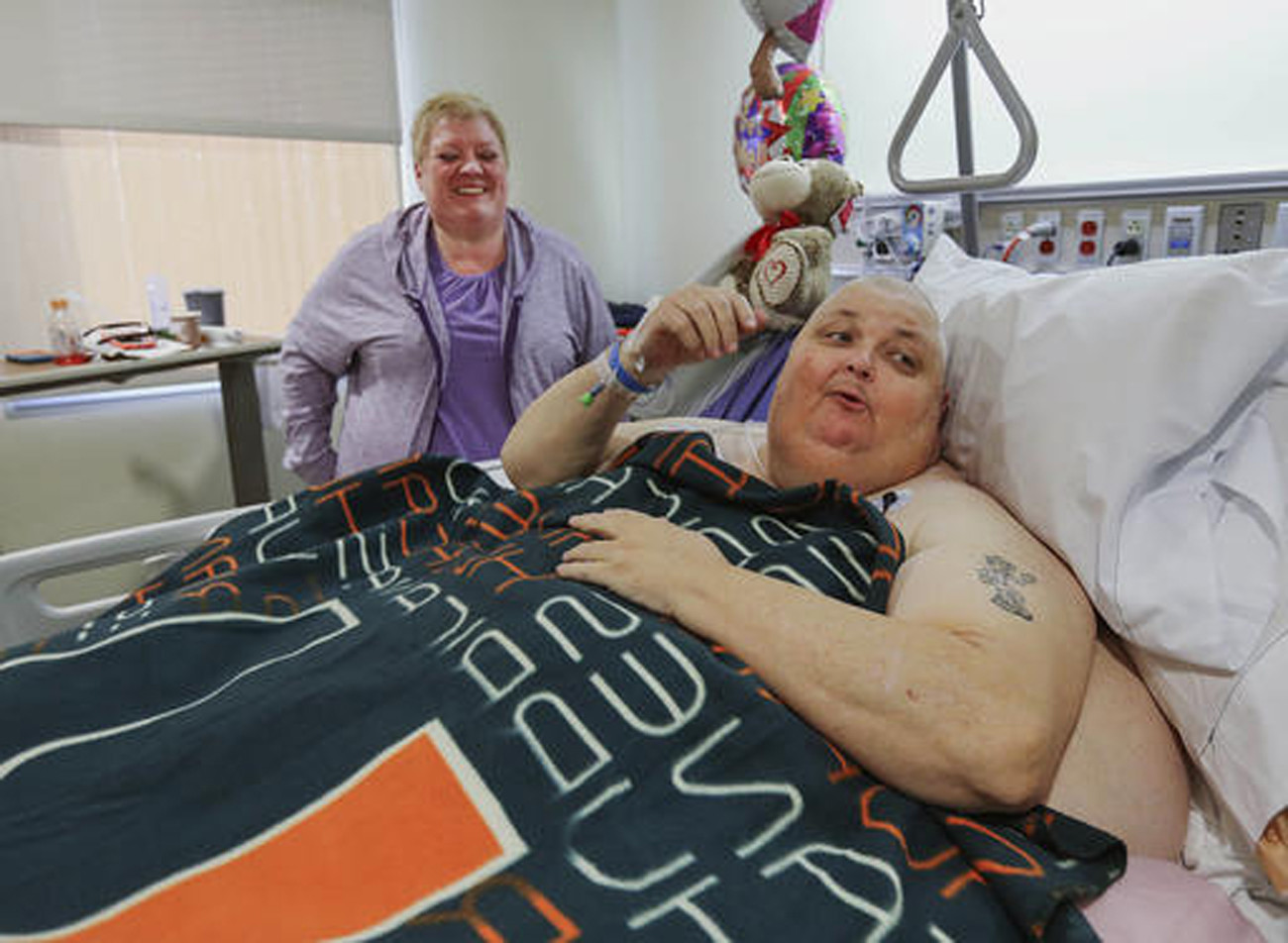 Man Who Was Told He Was Just Fat Has Pound Tumor Removed Chicago Tribune