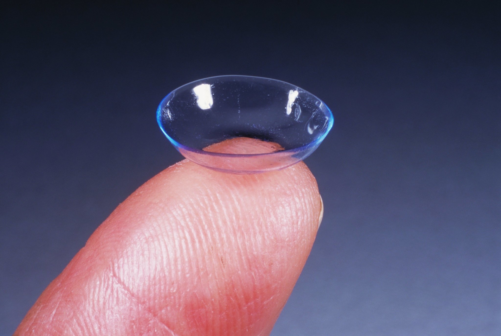 Doctor Finds 27 Contact Lenses Clumped Together In British Womans Eye