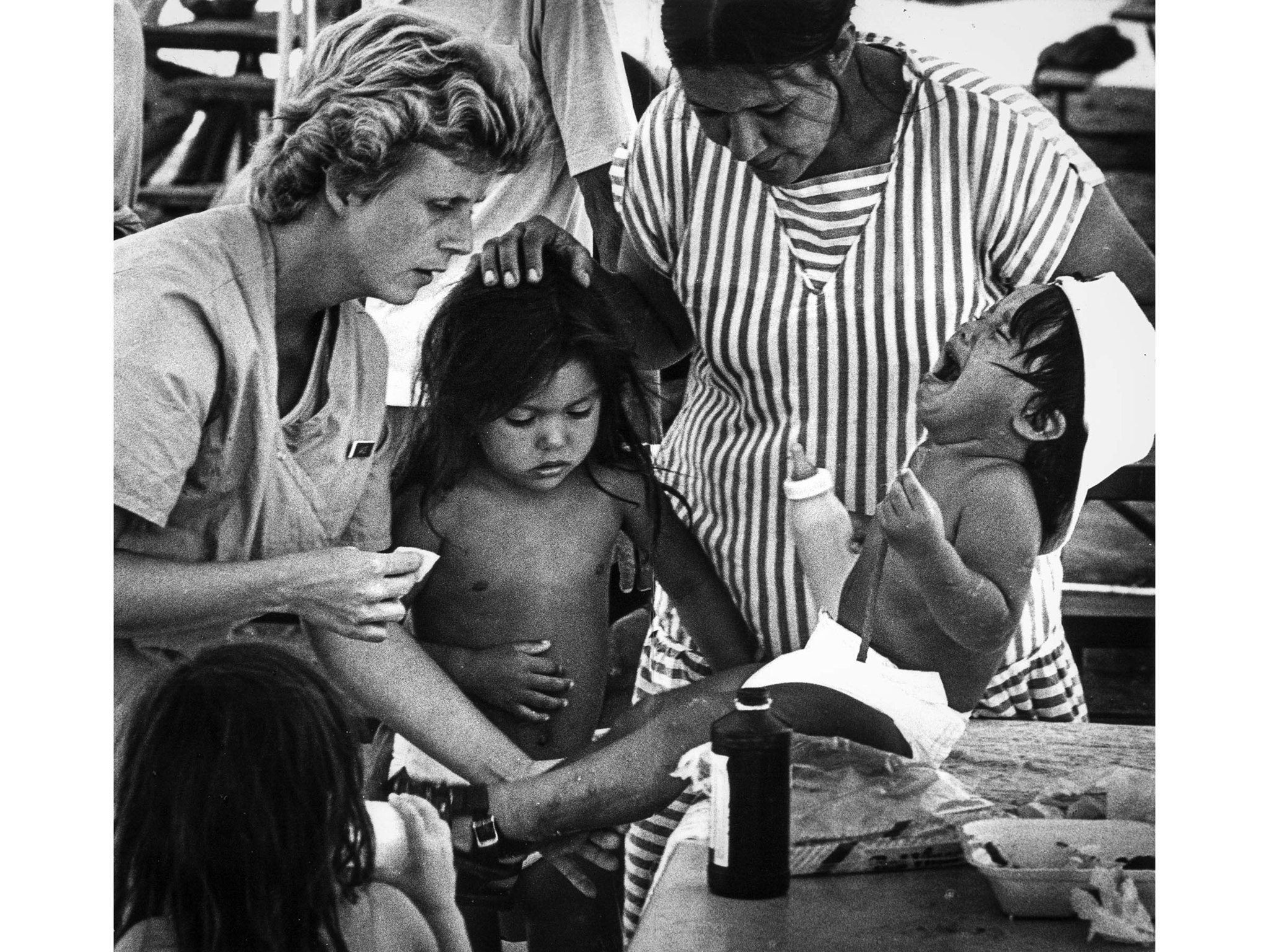 July 15, 1987: Volunteer Janice Estes of Fullerton examines 2-year-old boy with sores at Urban Campg